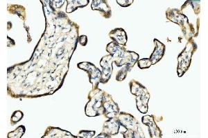 IHC analysis of BCKDK using anti-BCKDK antibody (ABIN7601470). (BCKDK anticorps  (AA 36-316))