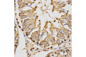 Immunohistochemistry (IHC) image for anti-Histone H3 (H3) (H3K27me) antibody (ABIN3023269) (Histone 3 anticorps  (H3K27me))