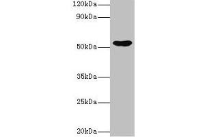 Western blot All lanes: EPHX1 antibody at 2 μg/mL + Hela whole cell lysate Secondary Goat polyclonal to rabbit IgG at 1/10000 dilution Predicted band size: 53 kDa Observed band size: 53 kDa (EPHX1 anticorps  (AA 1-455))