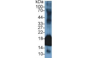 Detection of SOD1 in Rabbit Uterus lysate using Polyclonal Antibody to Superoxide Dismutase 1 (SOD1) (SOD1 anticorps  (AA 2-153))