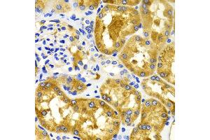 Immunohistochemistry of paraffin-embedded human kidney using CDK20 antibody (ABIN5971446) at dilution of 1/100 (40x lens).
