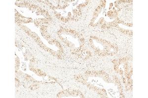 anti-CoaA (AA 550-600) antibody