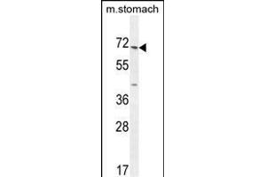 ESCO2 Antibody (Center) (ABIN654674 and ABIN2844369) western blot analysis in mouse stomach tissue lysates (35 μg/lane).