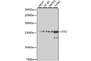 Western blot analysis of extracts of various cell lines using TTF2 Polyclonal Antibody at dilution of 1:1000. (TTF2 anticorps)