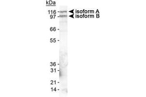 Western blot analysis of EPB41L3 in mouse brain lysate using EPB41L3 polyclonal antibody . (EPB41L3 anticorps  (AA 400-500))