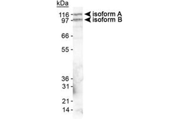 EPB41L3 anticorps  (AA 400-500)