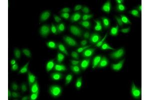 Immunofluorescence analysis of MCF7 cells using PRC1 antibody (ABIN6128502, ABIN6146124, ABIN6146125 and ABIN6222808).