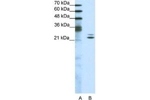 WB Suggested Anti-BUD31 Antibody Titration:  1. (BUD31 anticorps  (Middle Region))