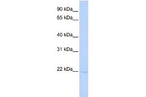 WB Suggested Anti-RER1 Antibody Titration:  0. (RER1 anticorps  (Middle Region))