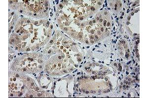 Immunohistochemical staining of paraffin-embedded Human Kidney tissue using anti-GSS mouse monoclonal antibody. (Glutathione Synthetase anticorps)