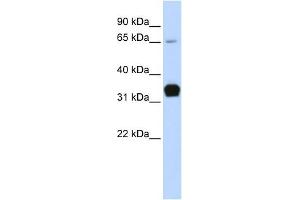 Troponin T Type 1 antibody used at 1 ug/ml to detect target protein. (TNNT1 anticorps)