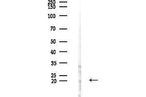 anti-Mitochondrial Ribosomal Protein S25 (MRPS25) (N-Term) antibody