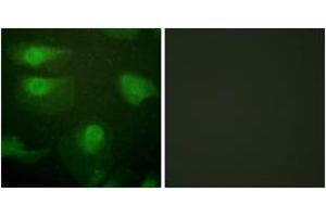 Immunofluorescence analysis of HeLa cells, using CaMK1-alpha (Phospho-Thr177) Antibody. (CAMK1 anticorps  (pThr177))