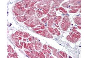 Anti-NANOS1 antibody IHC of human heart. (Nanos Homolog 1 anticorps  (AA 50-100))
