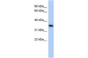WB Suggested Anti-MXI1 Antibody Titration: 0. (MXI1 anticorps  (Middle Region))