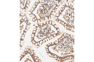 Immunohistochemical analysis of paraffin-embedded human small intestine tissue using (ABIN656961 and ABIN2846145) performed on the Leica® BOND RXm. (CLMP anticorps  (AA 81-110))