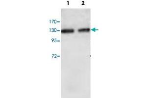 Western blot analysis of HUVEC cell (Lane 1) and human placenta (Lane 2) lysate with RBBP6 polyclonal antibody  at 1 : 1000 dilution. (RBBP6 anticorps  (Internal Region))