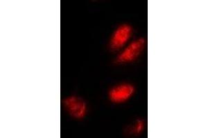 Immunofluorescent analysis of ASF1A staining in A549 cells.