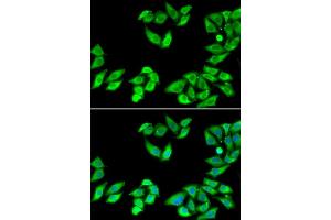 Immunofluorescence analysis of MCF7 cell using RPS14 antibody. (RPS14 anticorps)