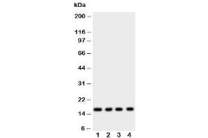Western blot testing of Myoglobin antibody and rat samples 1: skeletal muscle