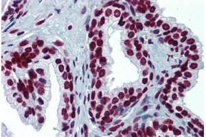 anti-Ribosomal Protein S6 Kinase, 90kDa, Polypeptide 2 (RPS6KA2) (AA 631-733) antibody