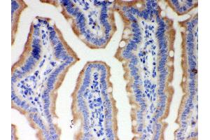 Anti- ITPR3 Picoband antibody, IHC(P) IHC(P): Mouse Intestine Tissue