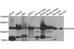 Western blot analysis of extracts of various cell lines, using DHTKD1 antibody. (DHTKD1 anticorps)