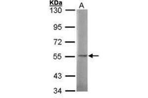 Image no. 1 for anti-N-Sulfoglucosamine Sulfohydrolase (SGSH) (AA 44-200) antibody (ABIN467364) (SGSH anticorps  (AA 44-200))