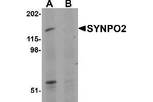Western Blotting (WB) image for anti-Synaptopodin 2 (SYNPO2) (N-Term) antibody (ABIN1031593) (SYNPO2 anticorps  (N-Term))