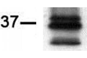 Western blot of PIM2 antibody (mAb). (PIM2 anticorps)