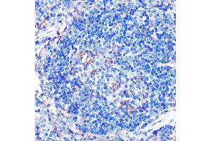 Immunohistochemistry of paraffin-embedded mouse spleen using CD86 Rabbit pAb (ABIN6131556, ABIN6138237, ABIN6138238 and ABIN6219508) at dilution of 1:100 (40x lens). (CD86 anticorps  (AA 30-247))