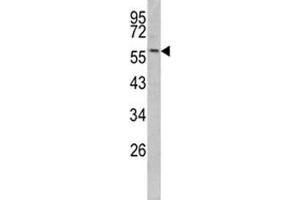 Western blot analysis of Keratin-14 antibody and mouse NIH3T3 lysate