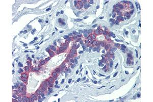 Anti-LIMD1 antibody IHC of human breast. (LIMD1 anticorps  (N-Term))