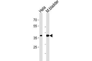 Western Blotting (WB) image for anti-Eukaryotic Translation Initiation Factor 3 Subunit H (EIF3H) antibody (ABIN3002723) (EIF3H anticorps)