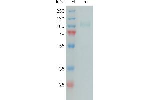 Human CFI Protein, His Tag on SDS-PAGE under reducing condition.