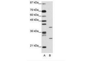 Image no. 1 for anti-ZFP36 Ring Finger Protein-Like 1 (ZFP36L1) (AA 46-95) antibody (ABIN202274) (ZFP36L1 anticorps  (AA 46-95))
