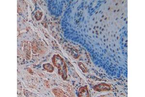 Used in DAB staining on fromalin fixed paraffin- embedded esophagus cancer tissue (SNCG anticorps  (AA 1-121))