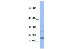 WB Suggested Anti-EDF1 Antibody Titration:  0. (EDF1 anticorps  (N-Term))