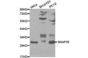 Western Blotting (WB) image for anti-Synaptosomal-Associated Protein, 25kDa (SNAP25) antibody (ABIN1874885) (SNAP25 anticorps)