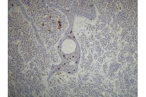 Immunohistochemistry (IHC) image for anti-CD1a (CD1a) (AA 240-256), (C-Term) antibody (ABIN870503) (CD1a anticorps  (C-Term))