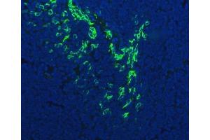 anti-Chromosome 4 Open Reading Frame 7 (C4orf7) (AA 18-51), (Middle Region) antibody