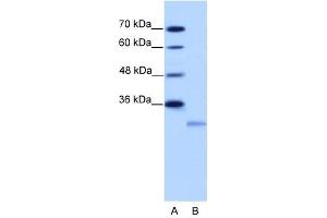EIF4E2 antibody used at 2. (EIF4E2 anticorps  (N-Term))