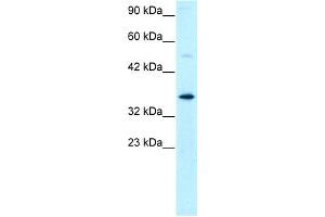 WB Suggested Anti-GTF2H3 Antibody Titration: 0.