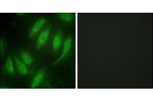 Immunofluorescence analysis of HeLa cells, using HES7 antibody. (HEXIM1 anticorps)