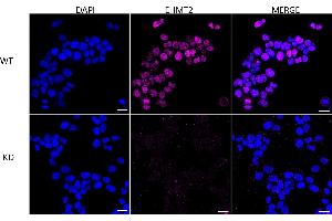 anti-Ankyrin Repeat-Containing Protein (EHMT2) antibody