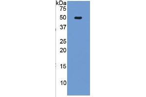 WB of Protein Standard: different control antibodies  against Highly purified E.