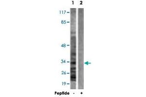 Western blot analysis of extracts from A-431 cells, using CASP6 polyclonal antibody . (Caspase 6 anticorps)