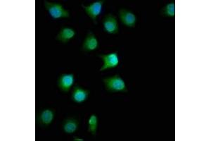 Immunofluorescence staining of A549 cells with ABIN7153110 at 1:100, counter-stained with DAPI. (FMN1 anticorps  (AA 354-487))