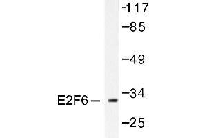 Image no. 1 for anti-E2F Transcription Factor 6 (E2F6) antibody (ABIN265390) (E2F6 anticorps)