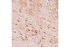 Immunohistochemistry of paraffin-embedded rat brain using OR10H3 antibody (ABIN7269086) at dilution of 1:100 (40x lens). (OR10H3 anticorps  (AA 1-100))